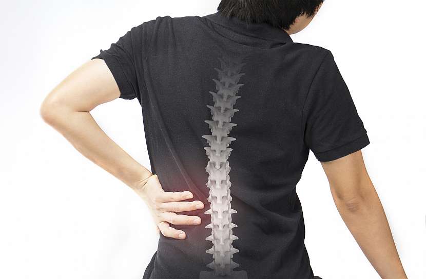 Jednou z hlavních prokázaných příčin vzniku osteoporózy je nedostatek vápníku v organismu 