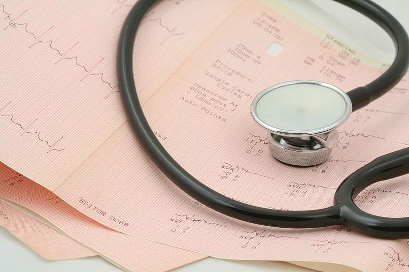 Ještě před deseti lety v Česku trápilo srdeční selhání podle odhadů na 200 tisíc lidí